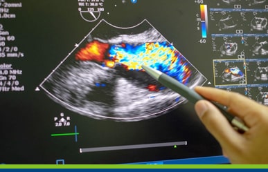 Cardiólogo en Arequipa - Cardiología en Arequipa