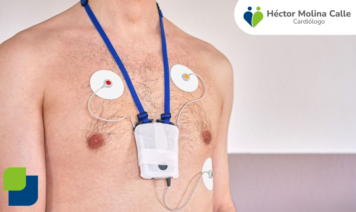 Cardiólogo en Arequipa - Cardiología en Arequipa