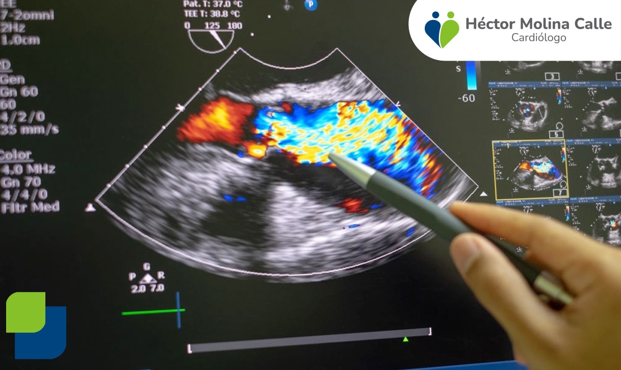 Cardiólogo en Arequipa - Cardiología en Arequipa
